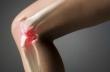 Как лечить артроз коленного сустава