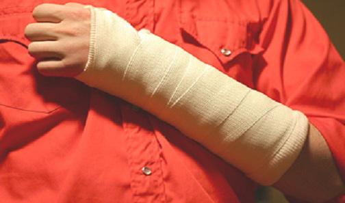 Как лечить перелом руки